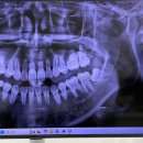 사랑니톡앤턱치과의원 | 망포 사랑니톡앤턱 사랑니 발치 후기