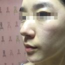 경성대 피부관리 :: 대연동 피부관리 이민하에스테틱 ♩