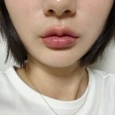 예쓰멍! | 용인 피부과 자연스러운 입술필러 국산 내돈내산 후기