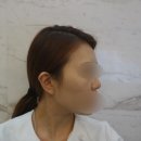 구미코필러후기 신부관리추천 봄맞이 클리닉 받아보세요!