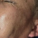 밝은SL의원 | [서울리거피부과] 좋은 제품은 나눠쓰라고 있는거죠!좋은 사람들과 좋은 제품 후기 남깁니다!!