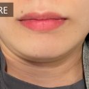 청담안즈피부과의원 이미지