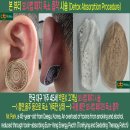 천지인한방병원 | 본 뷰티 보사법 패치로 내 몸의 독소제거와 통증 관리를 한꺼번에~! 보사법 패치 활용방법 소개