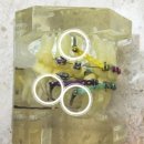 바른서울효치과교정과치과의원 | 춘천교정치과, 과개교합 + 옥니 문제가 동반되었던 환자 후기