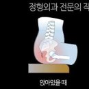 꼬리뼈 골절 증상 통증 나타날 때 회복 시기 챙겨야 할 모든 것 이미지