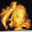 도안누리여성의원 이미지