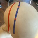 동양의학클리닉 - 전주시 덕진구 오공로 43-7 | Scalp Acupuncture 두피침 간단히 남기는 수업 후기