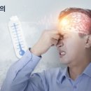 뇌졸중 이미지