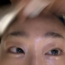 수진 스킨케어( 피부관리)