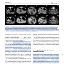 13마리의 개에서 gastric neoplasia의 clinical, ultrasound, CT finding의 비교 이미지