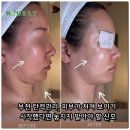 신호프라자 | [공지] 부천 탄력관리, 피부가 처져 보이기 시작했다면 놓치지 말아야 할 신호