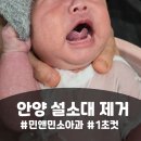 민앤민 | 안양 설소대 시술 민앤민 소아과 1초 컷 후기 (준비물, 비용, 주차 팁)