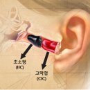 오티콘보청기강남센타 이미지