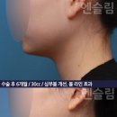 볼독