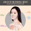 Re:앞턱만 손봤는대도 붓기때문에 회사 출근하기가 그래요(피브로한의원 답변) 이미지