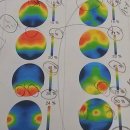 성인 ADHD 에 대해서. 이미지