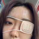 신사역피부과 이마필러 효과 본 후기! 자연스럽고 동글동글한 이마 완성