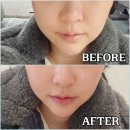 화신로 | 고양시 피부관리 화정역 루미너스에스테틱 티리온관리 후기