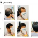재구가발 네이버블로그