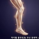 하지웰심장혈관흉부외과의원 | 부산 흉부외과 전문의가 알려드리는 하지정맥류와 하지불안증후군 구분법