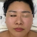 제이에이치짐 | 안양 피부관리 에스떼제이 평촌점 윤곽관리 솔직후기 전후사진 추천