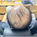 뷰티솔루션 이미지