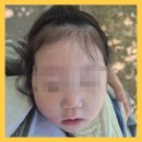 락티케어 로션 1% 100일 관리 후기