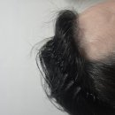 모바른의원 이미지