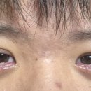 연세우리안과의원 네이버블로그