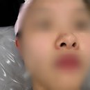용인 구성 올가드림뷰티 - 모공 스케일링 케어 후기