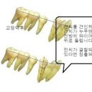 전치 앞(1) 이미지