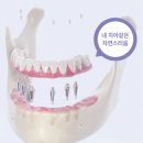 청주웰치과의원 이미지