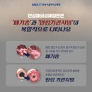 정도엠엔피 | 기침·가래 관리한 3가지 방법, 환절기가 덜 무섭다