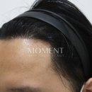 모먼트의원
