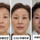 쏘자 이미지