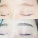 응봉헤어라인 이미지