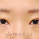 에이엠성형외과의원 이미지
