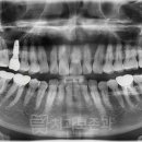 완산-158 이미지