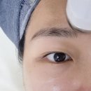 보누스킨