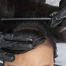 혜민웨이 | [사당 SMP] 컴플렉스였던 30대 여자 가르마 두피SMP 후기 - '혜민웨이'