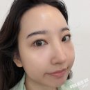 베다 | [의정부 피부관리] 쉬라인뷰티 에어바디에서 인생 첫 트리베다 페이스 윤곽관리 받고 온 찐 후기