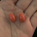 명현 | 이소티논 명현현상 버텨본 변화 부작용 후기