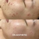 미래에스테틱 | 부천에스테틱_온에스테틱 부천점 방문 후기 | 미래를 보는 관리