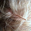 안아픈세상한의원 | 이젠 안 아픈 게 최고지! 강북안정한의원 방문기