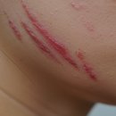 퍼스트케어약국 | 비판텐 종류 실사용 후기 전후있음