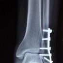 이승훈외과의원 이미지