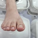 레푸스순천