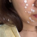 닥터자르트티트리 수딩스팟 여드름케어 한달후기 내돈내산