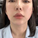 제이와이메디컬 이미지