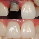 아이디얼치과기공소 이미지